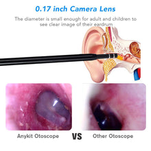 Load image into Gallery viewer, Ear Endoscope 3 in 1 Ear Cleaning Tool HD Visual Ear Spoon Multifunctional Earpick 5.5mm Mini Camera Android PC Ear Otoscope-Great Rehab Medical