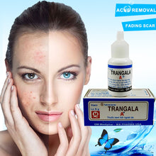 Load image into Gallery viewer, Vietnam TRANGALA 100% original Scar Removal Skin Repair Face Treatment Blackhead 8g/pcs-Great Rehab Medical
